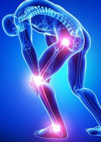 Коморбидность в ревматологии,  