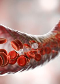 Профилактика сердечно-сосудистых заболеваний,  