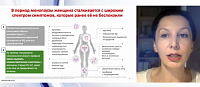 Мультидисциплинарные вопросы ведения женщин старше 40 лет с кардиометаболическими рисками: взгляд эндокринолога